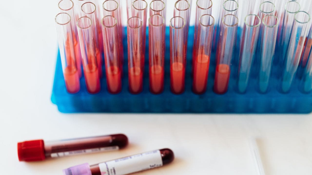 test allergie stagionali